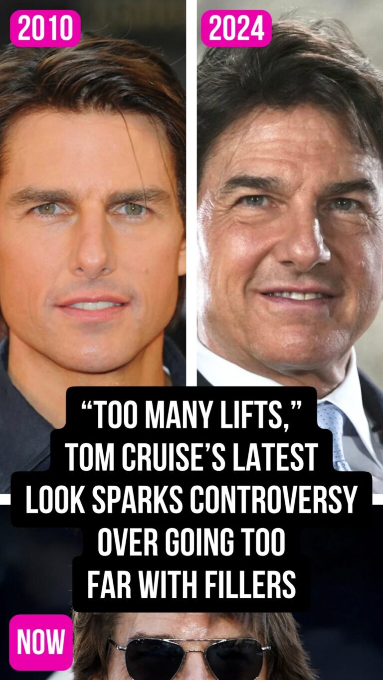 “Too Many Lifts,” Tom Cruise’s Latest Look Sparks Controversy Over Going Too Far With Fillers