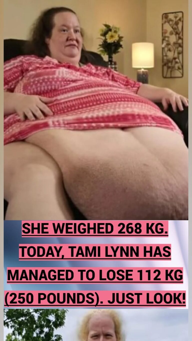He weighed 268 kg. Today, he inspires thousands with his impressive weight loss.