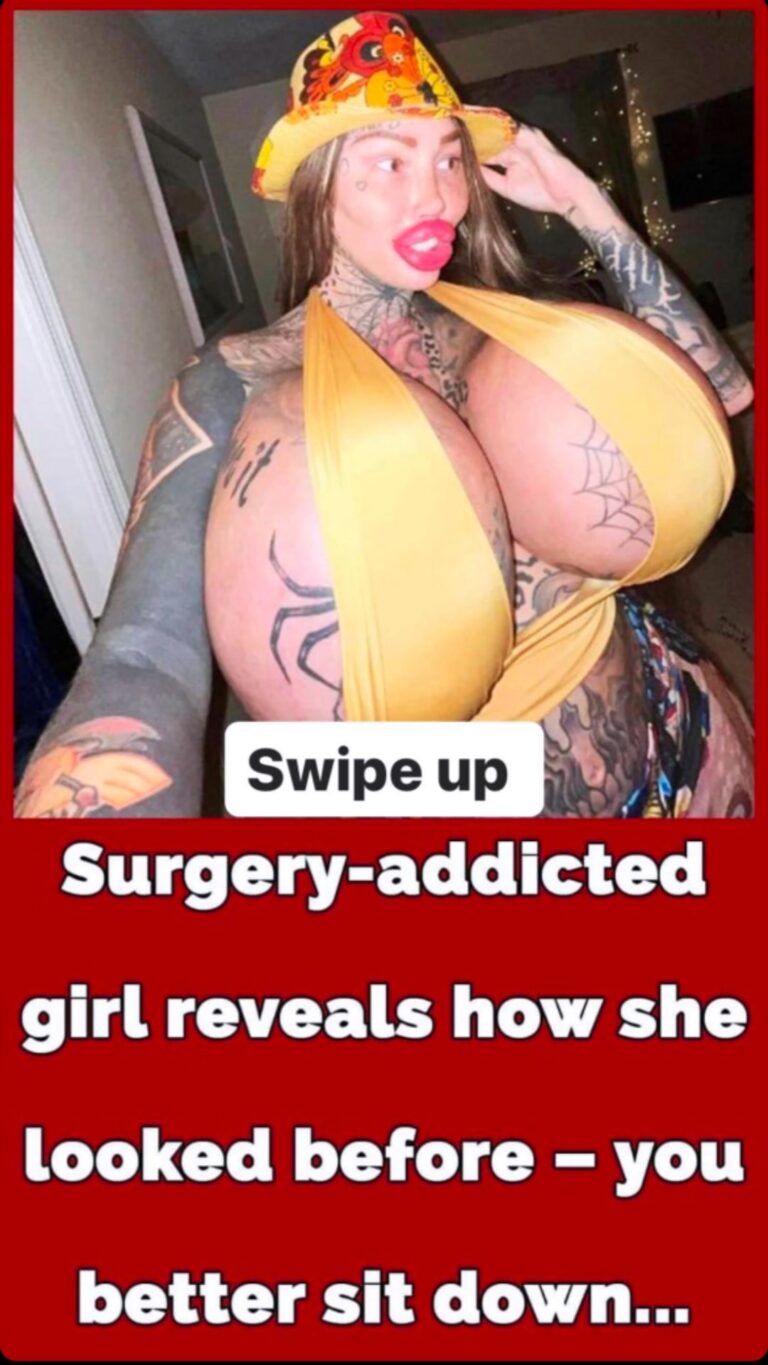 Pete Burns endured over 300 cosmetic surgeries on his face – and it left him bankrupt