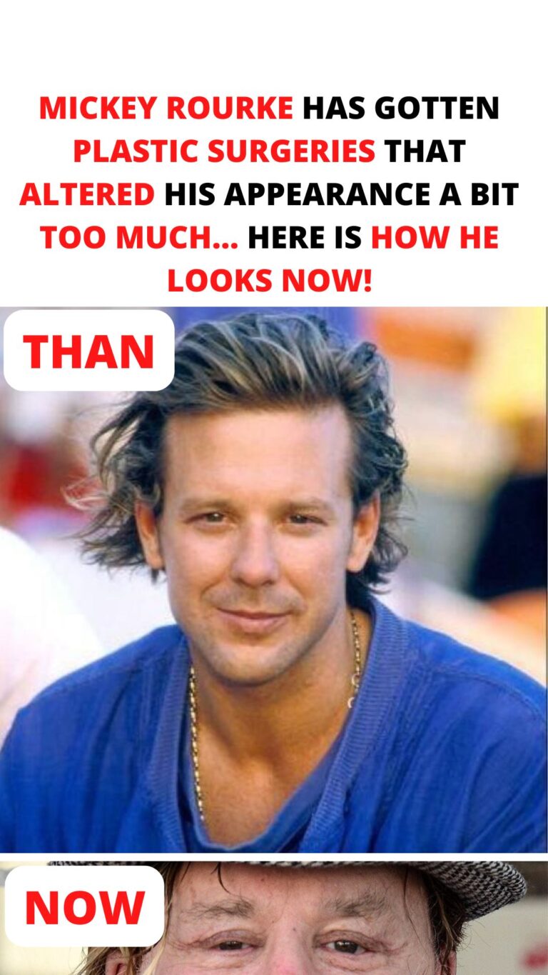 Mickey Rourke has gotten plastic surgeries that altered his appearance a bit too much… Here is how he looks now!