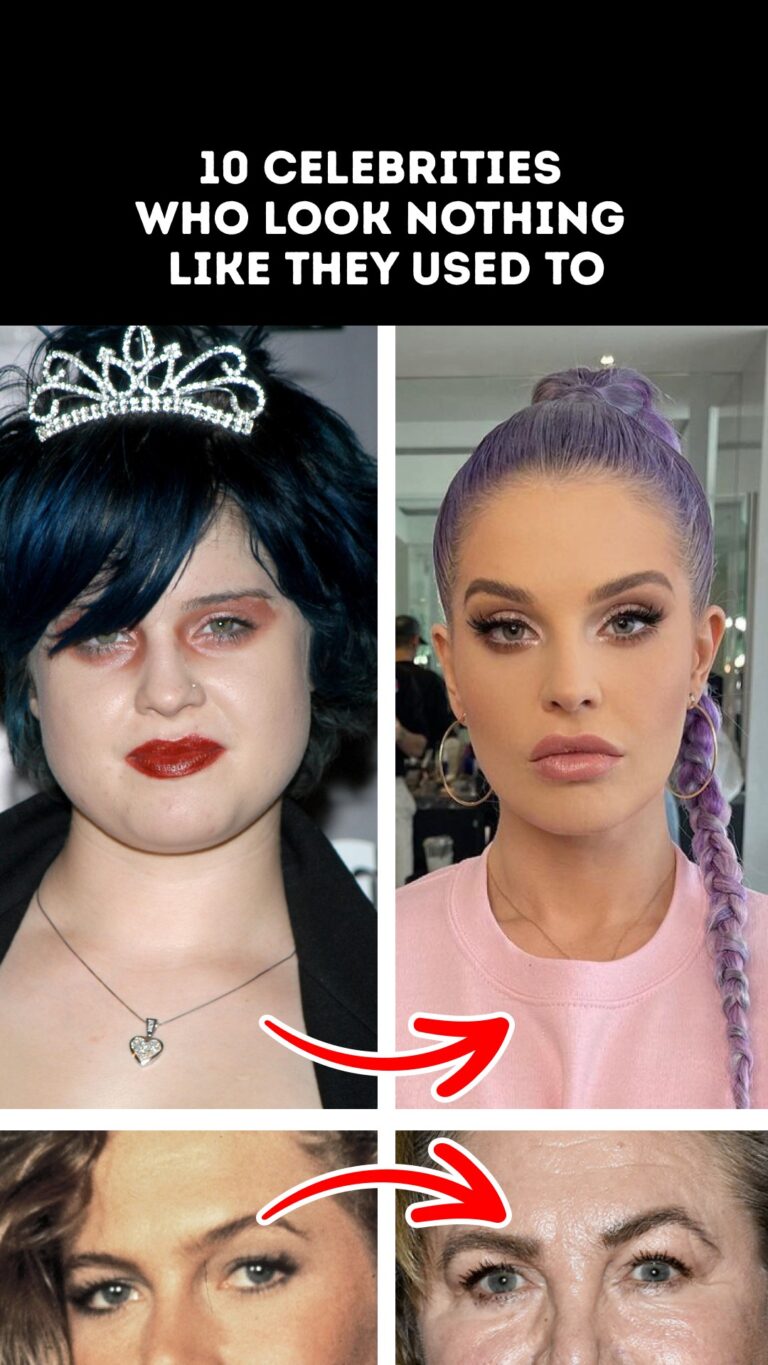 10 Celebrities Who Look Nothing Like They Used To