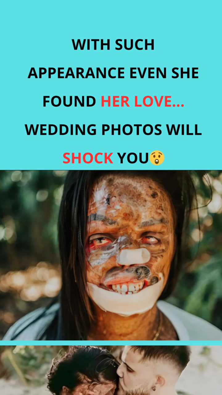 Love That Transcends Appearances: A Story of Resilience and Unbreakable Inner Beauty.
