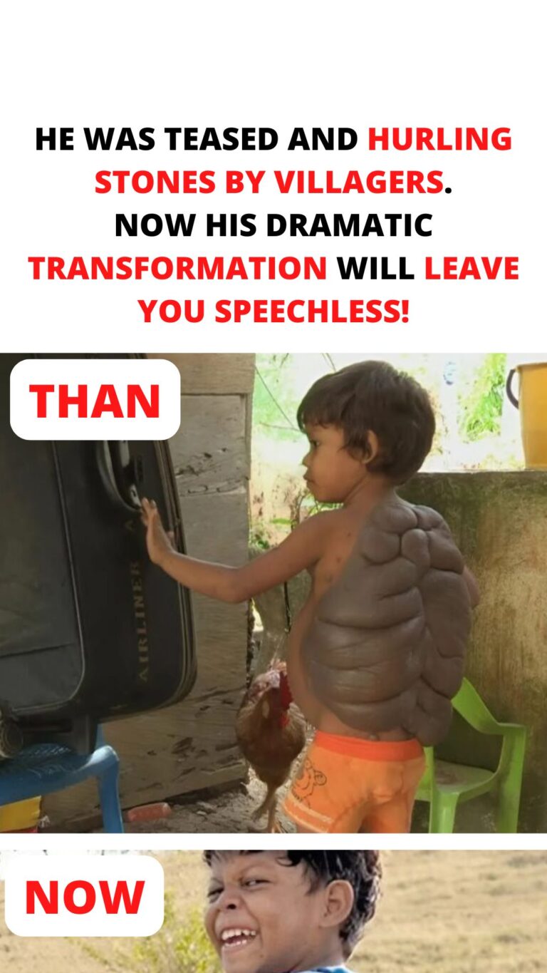 He Was Teased and Hurling Stones by Villagers. Now His Dramatic Transformation Will Leave You Speechless!