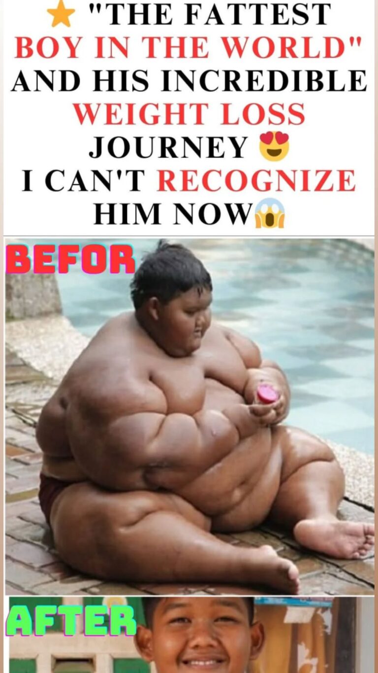 From Burdened to Brave: Arya Permana’s Shocking 238-Pound Transformation That Inspired the World