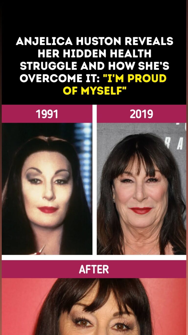Anjelica Huston Opens Up About Her Private Health Battle and What Helped Her Heal