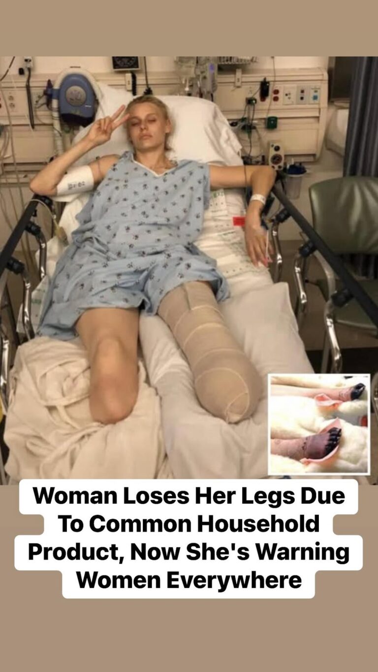 Woman Loses Her Legs Due To Common Household Product, Now She’s Warning Women Everywhere