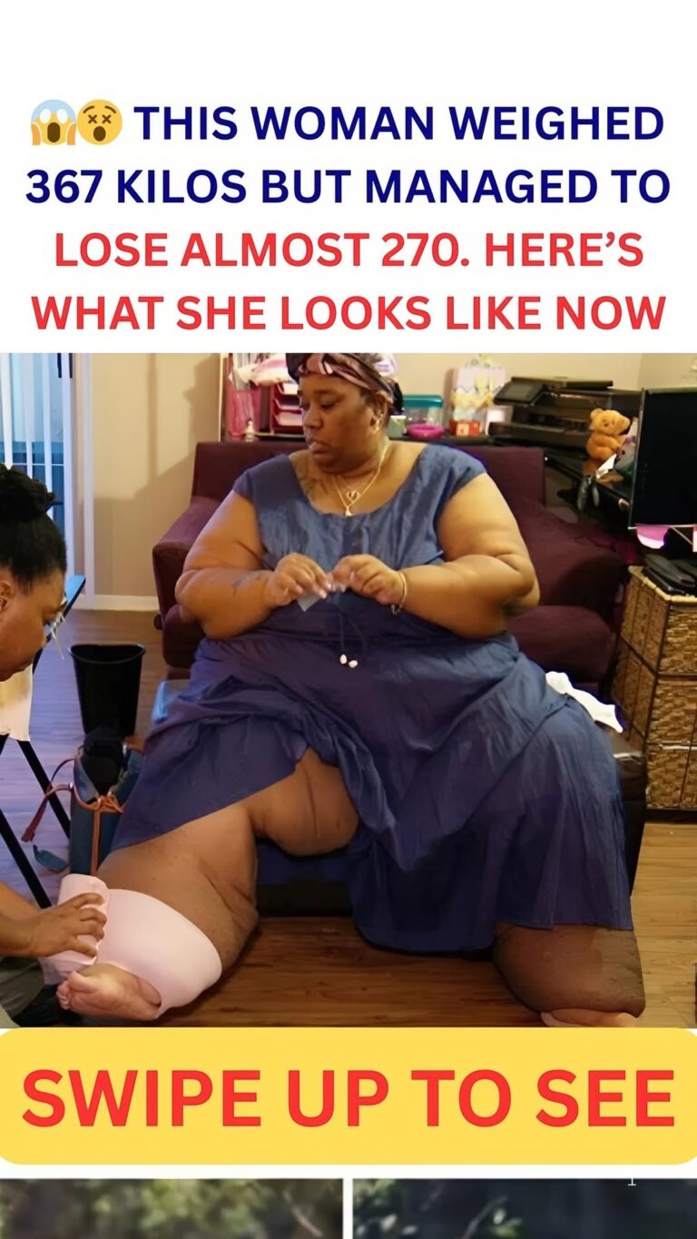 This woman weighed 367 kilograms but managed to lose almost 270: here’s what she looks like now