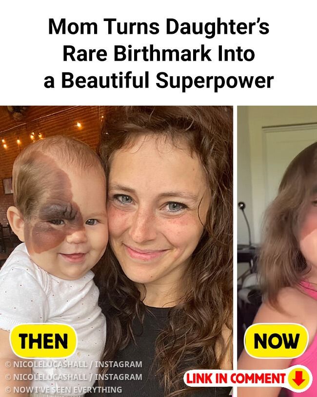 Mom Turns Daughter’s Rare Birthmark Into a Beautiful Superpower
