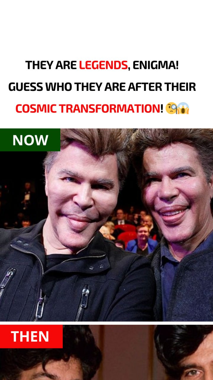 Due to numerous plastic surgeries, these brothers have severely altered their appearance. What did they look like before?